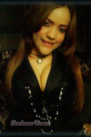 151209 - Noris Age: 39 - Dominican Republic